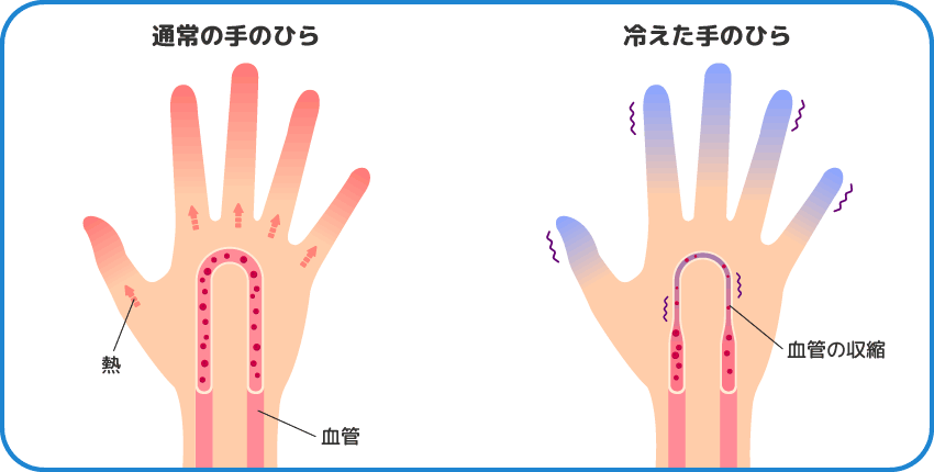 通常の手のひら　冷えた手のひら　カイロなどで温めるだけではキリがない！